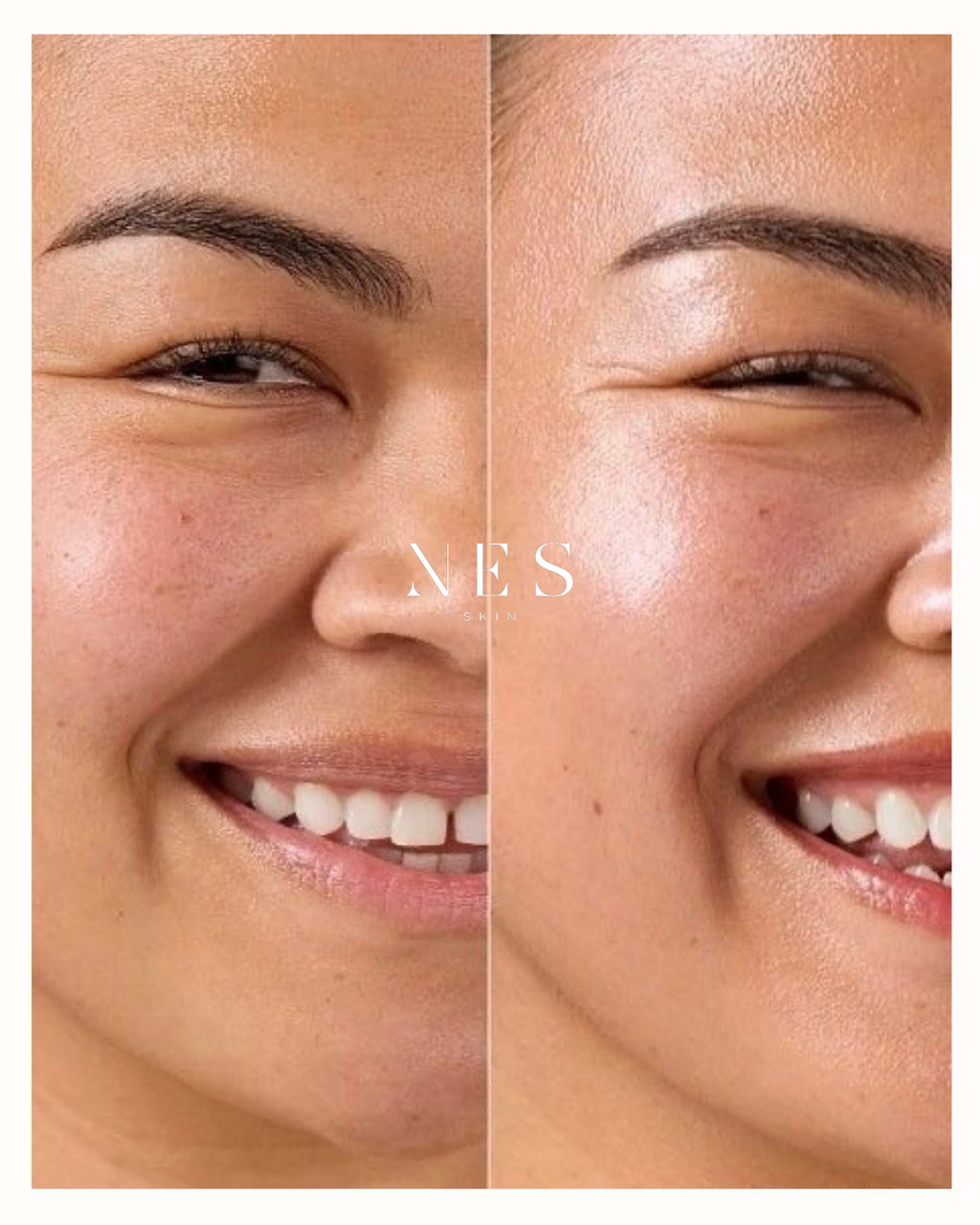 Creme Facial Glass Skin Multi-Vitaminico