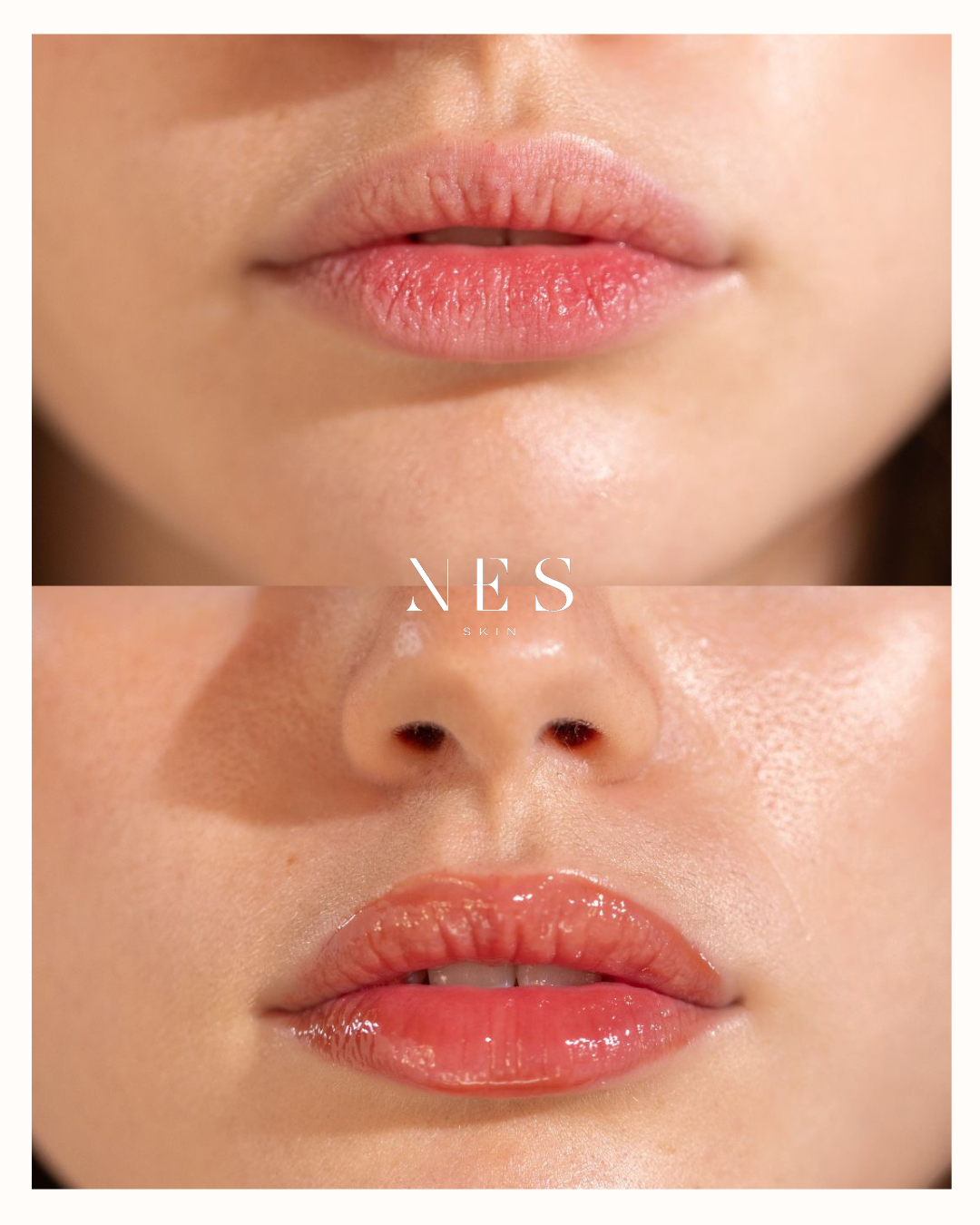 Lip OIL Mango Treatment